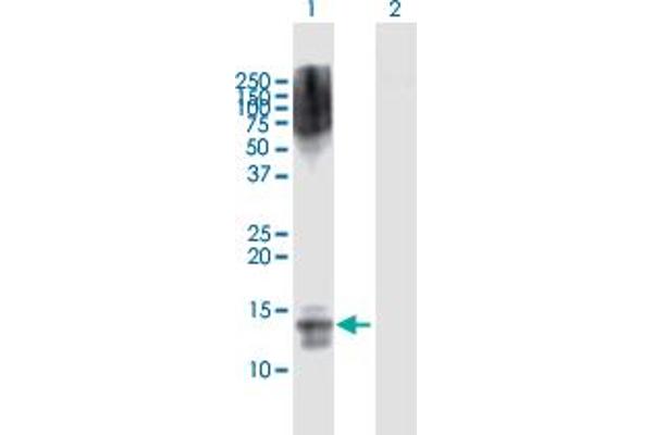 NFATC2IP antibody  (AA 1-138)