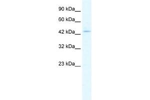 WB Suggested Anti-CLIC5 Antibody Titration:  1. (CLIC5 Antikörper  (Middle Region))
