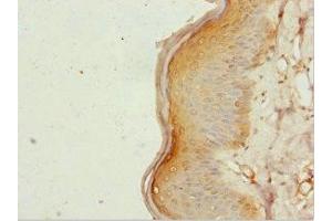 Immunohistochemistry of paraffin-embedded human skin tissue using ABIN7161952 at dilution of 1:100 (ZC3HC1 Antikörper  (AA 1-260))