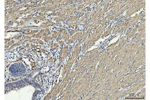 IHC analysis of TP53I13 using anti-TP53I13 antibody (ABIN7601220). (TP53I13 Antikörper  (AA 30-365))
