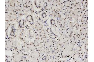 Immunostaining (ISt) image for anti-Core-binding Factor, Runt Domain, alpha Subunit 2, Translocated To, 2 (CBFA2T2) (AA 201-304) antibody (ABIN522603)