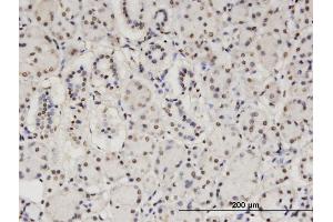 Immunoperoxidase of monoclonal antibody to CBFA2T2 on formalin-fixed paraffin-embedded human salivary gland.