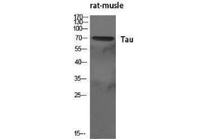 Western Blotting (WB) image for anti-tau Protein (Ser83) antibody (ABIN3187174) (tau Antikörper  (Ser83))