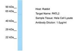 Image no. 1 for anti-Protein Associated with Topoisomerase II Homolog 2 (PATL2) (AA 313-362) antibody (ABIN6750126)
