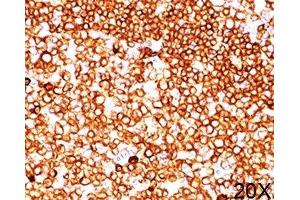 IHC testing of human tonsil (20X) stained with CD79a antibody (JCB117). (CD79a Antikörper  (AA 202-216))