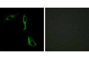 Peptide - +Immunohistochemistry analysis of paraffin-embedded human breast carcinoma tissue using ADRA1D antibody. (ADRA1D Antikörper)