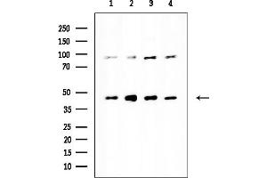 anti-Stomatin (EPB72)-Like 1 (STOML1) antibody