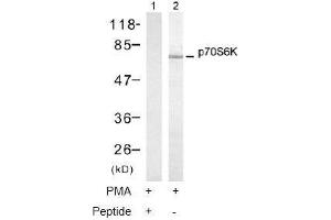 Image no. 1 for anti-Ribosomal Protein S6 Kinase, 70kDa, Polypeptide 1 (RPS6KB1) (Thr421) antibody (ABIN197498) (RPS6KB1 Antikörper  (Thr421))