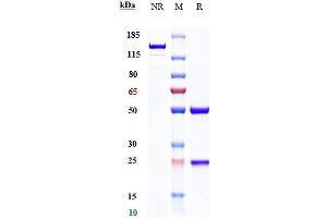 Anti-TPBG Reference Antibody (ASN004) on SDS-PAGE under reducing (R) condition.