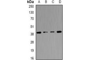 Western blot analysis of Tropomodulin-4 expression in mouse heart (A), mouse skeletal muscle (B), mouse brain (C), rat skeletal muscle (D) whole cell lysates. (Tropomodulin 4 Antikörper)