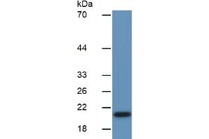 WB of Protein Standard: different control antibodies  against Highly purified E.