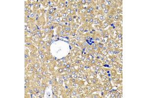 Immunohistochemistry (IHC) image for anti-Leptin Receptor (LEPR) antibody (ABIN7268210)