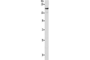Gel: 10 % SDS-PAGE, Lysate: 40 μg, Lane: A549 cells, Primary antibody: ABIN7191635(NFASC Antibody) at dilution 1/400, Secondary antibody: Goat anti rabbit IgG at 1/8000 dilution, Exposure time: 1 minute (NFASC Antikörper)