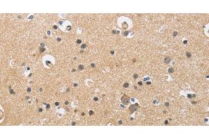 Immunohistochemistry of paraffin-embedded Human brain using CKMT2 Polyclonal Antibody at dilution of 1:60 (CKMT2 Antikörper)