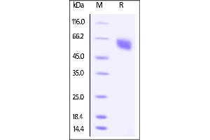 Biotinylated Human BTLA (31-134), Fc Tag on SDS-PAGE under reducing (R) condition. (BTLA Protein (AA 31-134) (Fc Tag,AVI tag,Biotin))