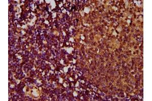 IHC image of ABIN7173860 diluted at 1:500 and staining in paraffin-embedded human lymph node tissue performed on a Leica BondTM system.