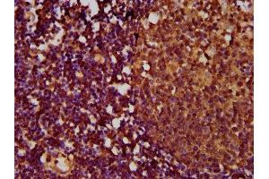 IHC image of ABIN7173860 diluted at 1:500 and staining in paraffin-embedded human lymph node tissue performed on a Leica BondTM system. (TNFRSF18 Antikörper  (AA 90-162))
