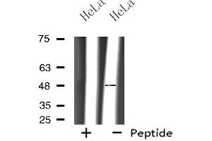 Western blot analysis of extracts from HeLa cells, using OPRM1 antibody. (Mu Opioid Receptor 1 Antikörper  (C-Term))
