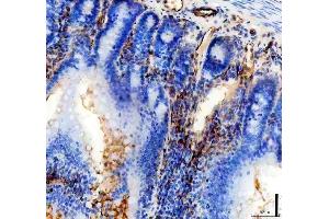IHC analysis of CD31/Pecam1 using anti-CD31/Pecam1 antibody (ABIN7601662). (CD31 Antikörper  (AA 41-258))