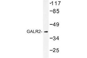 Image no. 1 for anti-Galanin Receptor 2 (GALR2) antibody (ABIN317752) (GALR2 Antikörper)