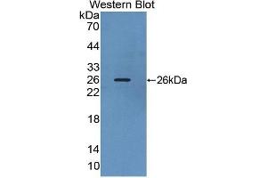 Western Blotting (WB) image for anti-Suppressor of Cytokine Signaling 3 (SOCS3) antibody (Biotin) (ABIN1174917) (SOCS3 Antikörper  (Biotin))