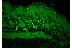 Immunohistochemistry analysis using Rabbit Anti-HSP110 Polyclonal Antibody (ABIN863193 and ABIN863194). (HSPA4 Antikörper)