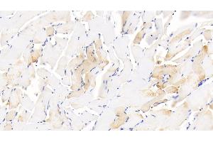 Immunohistochemistry (IHC) image for anti-Growth Differentiation Factor 5 (GDF5) (AA 382-501) antibody (ABIN7434680)