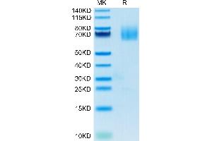 Human CD27 Ligand on Tris-Bis PAGE under reduced condition. (CD70 Protein (AA 39-193) (Fc Tag))