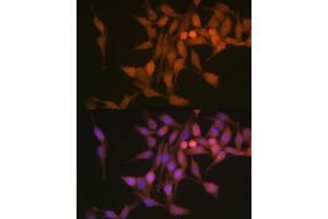 Immunofluorescence analysis of HeLa cells using PSMB6 Polyclonal Antibody (ABIN1682336, ABIN3018469, ABIN3018470 and ABIN6220475) at dilution of 1:100 (40x lens). (PSMB6 Antikörper  (AA 35-239))