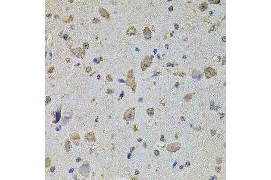 Immunohistochemistry (Paraffin-embedded Sections) (IHC (p)) image for anti-Eukaryotic Translation Initiation Factor 4A2 (EIF4A2) (AA 1-270) antibody (ABIN1679695)