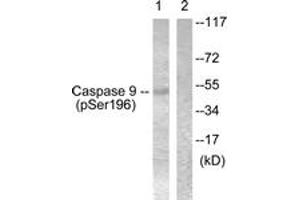 Western blot analysis of extracts from 293 cells treated with Calyculin 50nM 30', using Caspase 9 (Phospho-Ser196) Antibody. (Caspase 9 Antikörper  (pSer196))