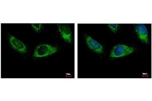 ICC/IF Image HPS3 antibody [C3], C-term detects HPS3 protein at cytoplasm by immunofluorescent analysis.