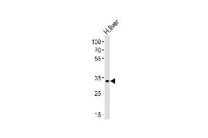 Leucine Rich Transmembrane and 0-Methyltransferase Domain Containing (LRTOMT) (AA 2-36), (N-Term) Antikörper