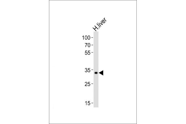 Leucine Rich Transmembrane and 0-Methyltransferase Domain Containing (LRTOMT) (AA 2-36), (N-Term) Antikörper