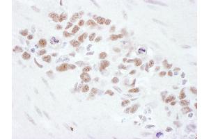 Immunohistochemistry (IHC) image for anti-MRE11 Meiotic Recombination 11 Homolog A (S. Cerevisiae) (MRE11A) (AA 658-708) antibody (ABIN7454999) (Mre11 Antikörper  (AA 658-708))