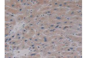IHC-P analysis of Human Liver Tissue, with DAB staining. (AKT2 Antikörper  (AA 142-412))
