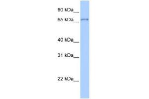 WB Suggested Anti-ZNF76 Antibody Titration:  0. (ZNF76 Antikörper  (Middle Region))
