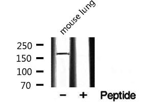 Western blot analysis on mouse lung lysate using RON Antibody. (MST1R Antikörper  (C-Term))