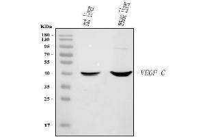 Western blot analysis of Vegfc using anti-Vegfc antibody (ABIN7599683).