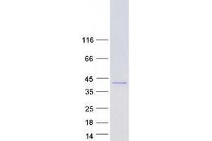 Western Blotting (WB) image for Aldo-Keto Reductase Family 1, Member B1 (Aldose Reductase) (AKR1B1) protein (Myc-DYKDDDDK Tag) (ABIN2714500)