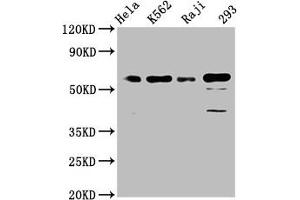 Western Blot Positive WB detected in: Hela whole cell lysate, K562 whole cell lysate, Raji whole cell lysate, 293 whole cell lysate All lanes: Cdc25C antibody at 1. (Rekombinanter CDC25C Antikörper)