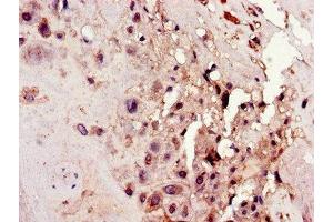 Immunohistochemistry of paraffin-embedded human placenta tissue using ABIN7162131 at dilution of 1:100 (Uncharacterized Protein C4orf26 (ODAPH) (AA 24-130) Antikörper)