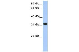 ETFA antibody used at 1 ug/ml to detect target protein. (ETFA Antikörper)