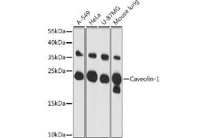 Western blot analysis of extracts of various cell lines, using Caveolin-1 antibody (ABIN6131271, ABIN6137992, ABIN6137993 and ABIN6218615) at 1:3000 dilution.
