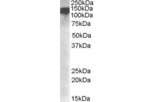 EB09297 (1µg/ml) staining of nuclear HeLa lysate (35µg protein in RIPA buffer). (DHX9 Antikörper  (Internal Region))