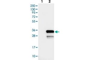 Western blot analysis of Lane 1: Negative control (vector only transfected HEK293T lysate), Lane 2: Over-expression Lysate (Co-expressed with a C-terminal myc-DDK tag (~3. (LYSMD1 Antikörper)
