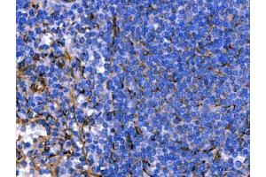 IHC analysis of Hsp47/SERPINH1 using anti-Hsp47/SERPINH1 antibody (ABIN3043331).