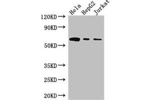 Western Blot Positive WB detected in: Hela whole cell lysate, HepG2 whole cell lysate, Jurkat whole cell lysate All lanes: HPSE antibody at 3 μg/mL Secondary Goat polyclonal to rabbit IgG at 1/50000 dilution Predicted band size: 62, 55, 54, 43 kDa Observed band size: 62 kDa (HPSE Antikörper  (AA 263-523))