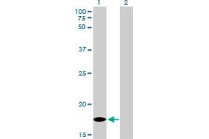 Western Blotting (WB) image for anti-Multiple Coagulation Factor Deficiency 2 (MCFD2) (AA 1-147) antibody (ABIN599316) (MCFD2 Antikörper  (AA 1-147))