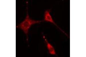 ABIN6269331 staining  HeLa cells by IF/ICC. (Caldesmon Antikörper  (C-Term))
